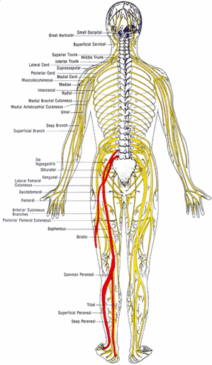 sciatica.gif